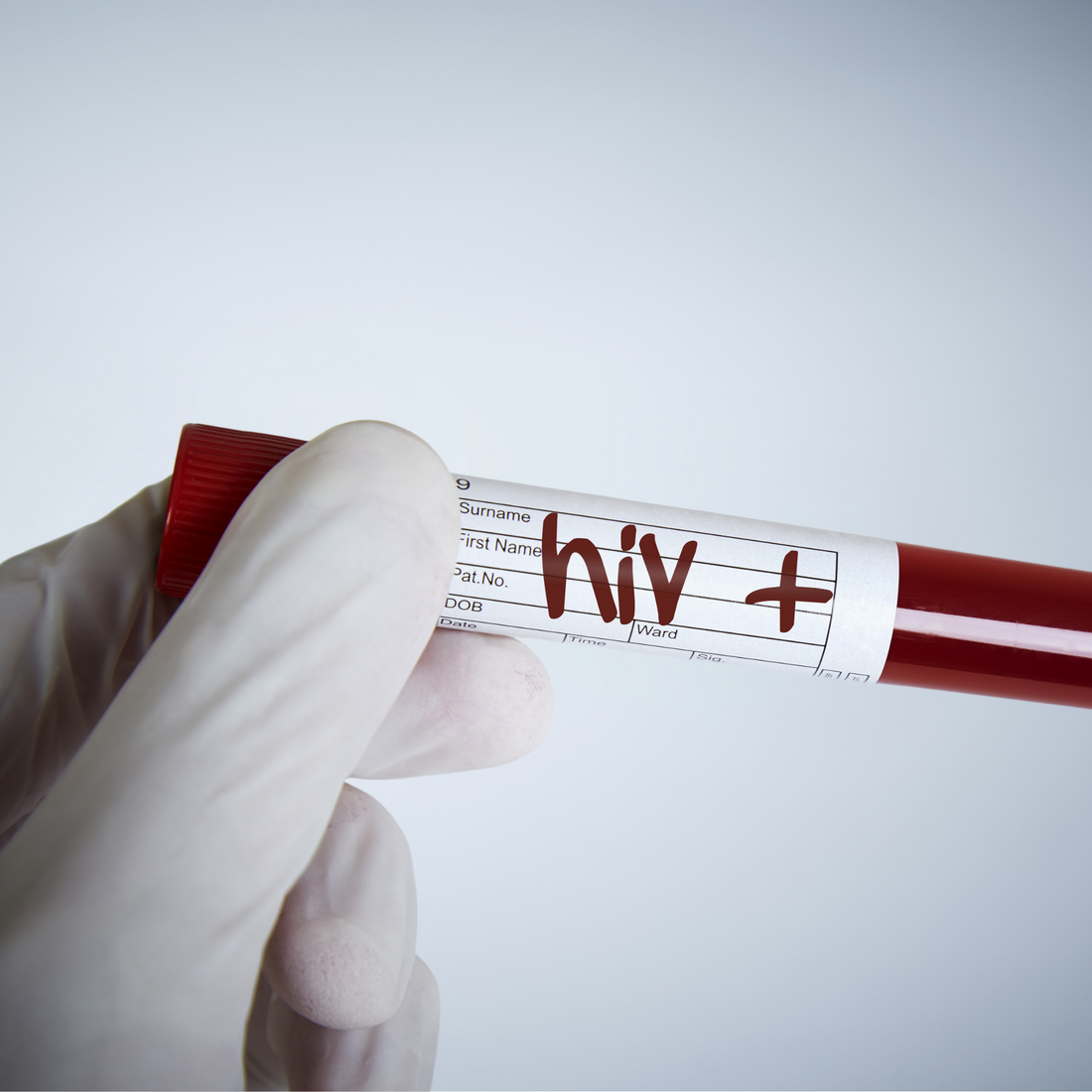 Common HIV Symptoms Experienced by Filipinos